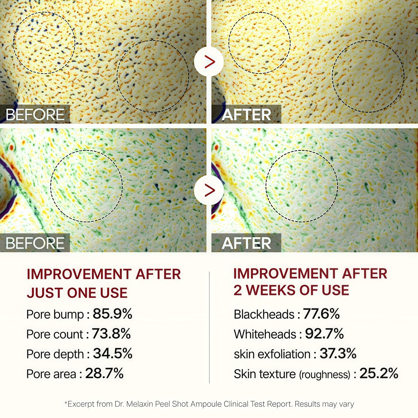 Dr.Melaxin Peel Shot Glow Rice Ampoule